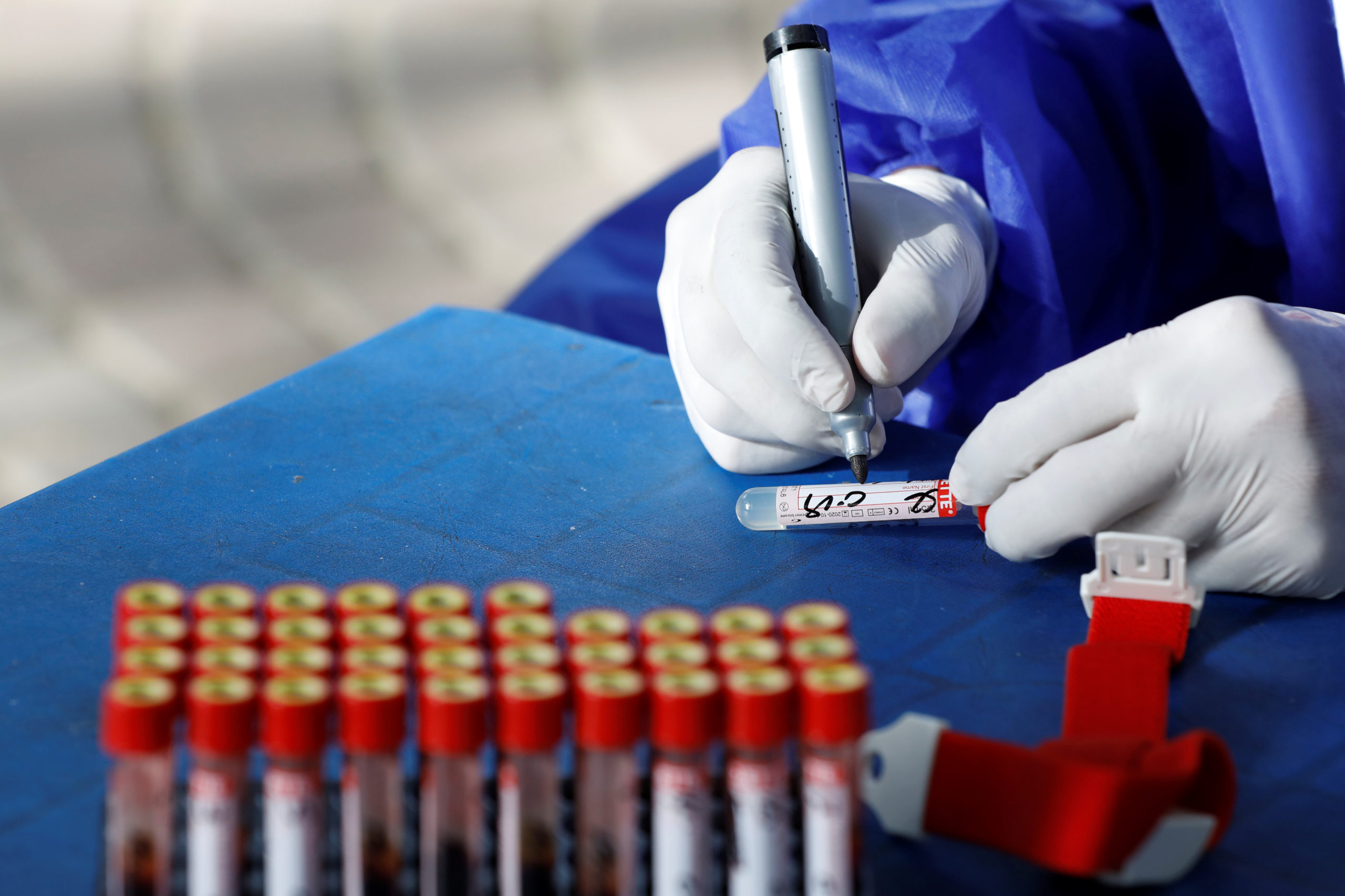 Coronavirus: Les tests PCR entièrement remboursés en France